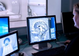 CT scan, close up image of the brain - NIHR Cambridge BRC image
