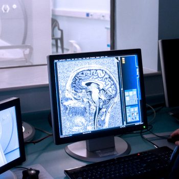 CT scan, close up image of the brain - NIHR Cambridge BRC image