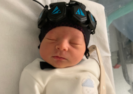 Baby with non-invasive sensors on their head to monitor brain activity during sleep. Photo reproduced with permission from Uchitel J et al, Neuroimage 2022 in press.