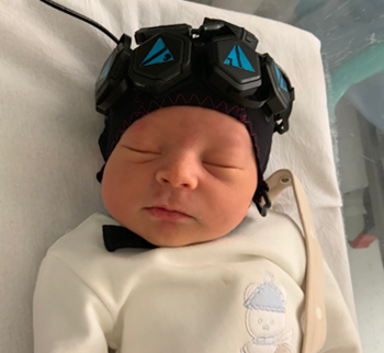 Baby with non-invasive sensors on their head to monitor brain activity during sleep. Photo reproduced with permission from Uchitel J et al, Neuroimage 2022 in press.