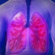 Upper Body, Lung, Copd, Disease, Doctor