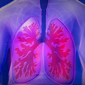 Upper Body, Lung, Copd, Disease, Doctor