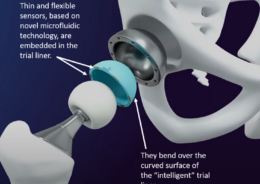 An exploded view of the thin and flexible sensors and the “intelligent” trial liner for the breakthrough technology in hip replacement being developed at Cambridge