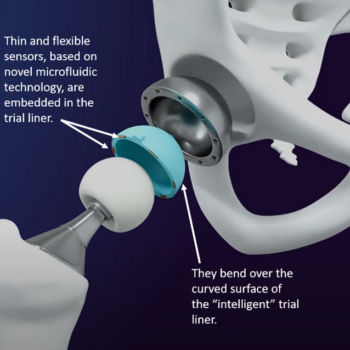 An exploded view of the thin and flexible sensors and the “intelligent” trial liner for the breakthrough technology in hip replacement being developed at Cambridge